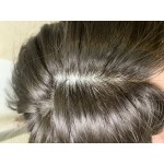  髪の毛-植毛-シリコン限定  + 50,000円 