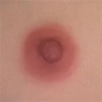 #3 