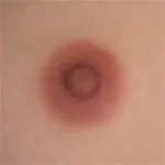 #5 